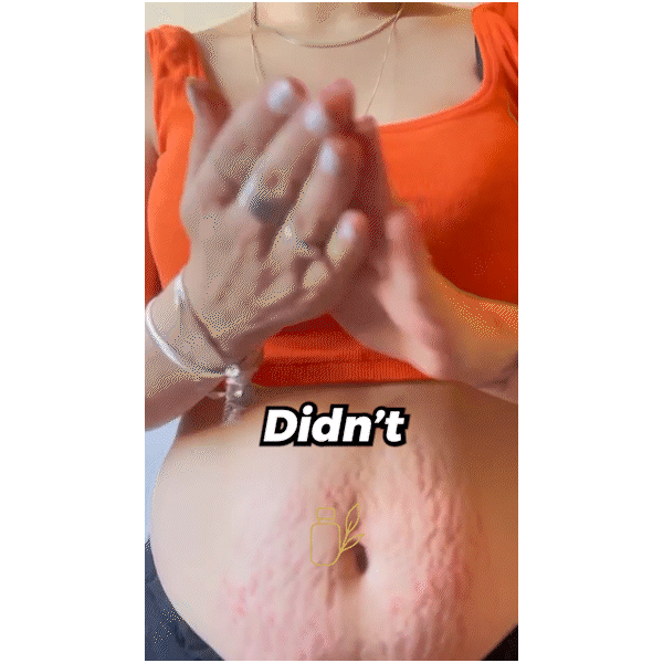 Smooth Skin Miracle Cream